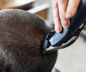 blog hair style post transplant