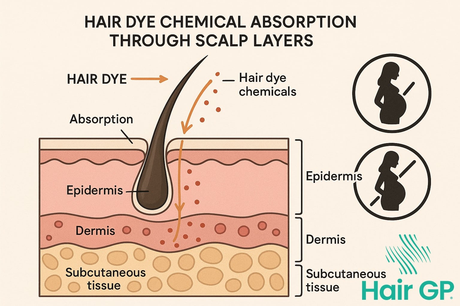 Diagram showing how hair dye chemicals absorb through scalp during pregnancy