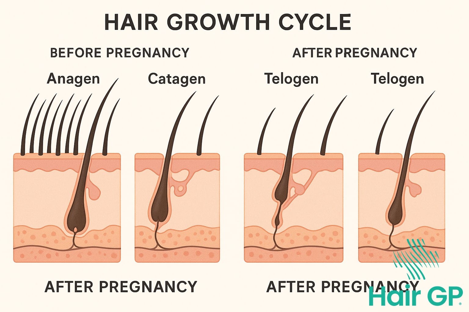 Hair growth cycle diagram showing anagen catagen telogen phases during pregnancy and postpartum
