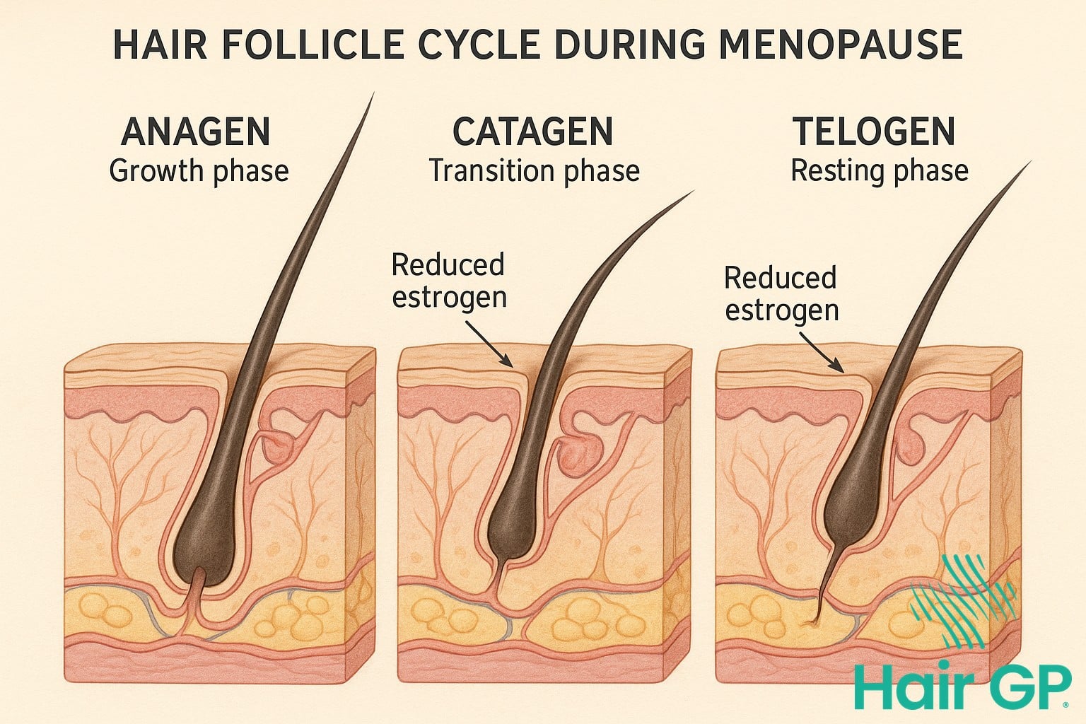 Diagram showing hair follicle changes during menopause with hormonal impact