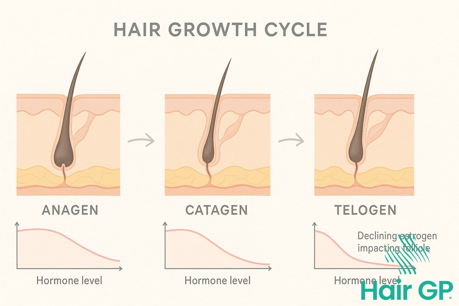 Diagram showing how menopause hormones affect the hair growth cycle