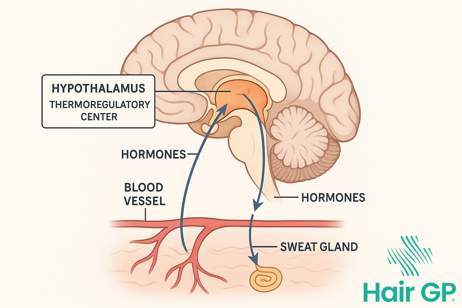 Diagram of brain's thermoregulatory center showing hot flash pathways