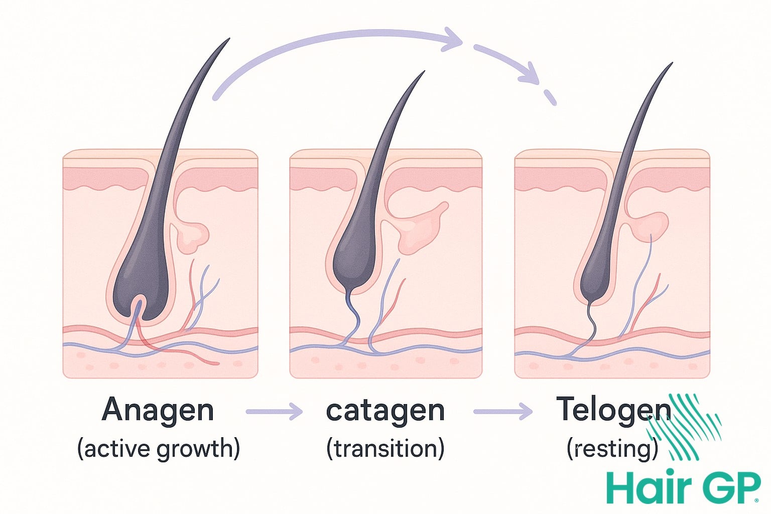 Diagram showing the three phases of hair growth cycle: anagen, catagen, and telogen