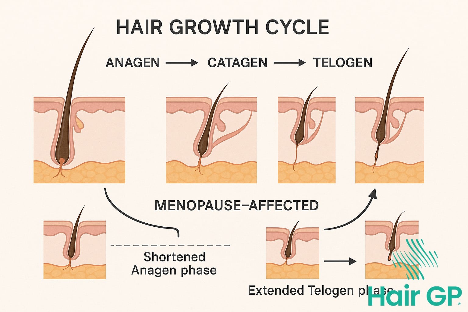 Diagram comparing normal hair growth cycle to menopause-affected hair growth cycle