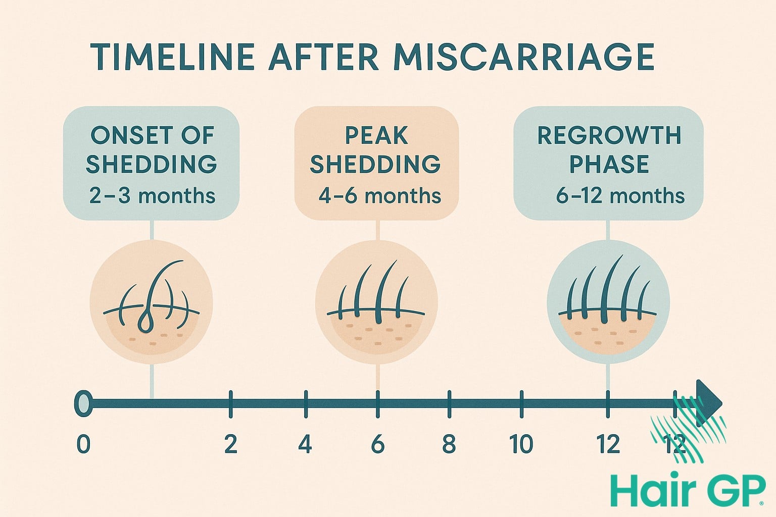 Timeline showing hair loss and regrowth phases after miscarriage
