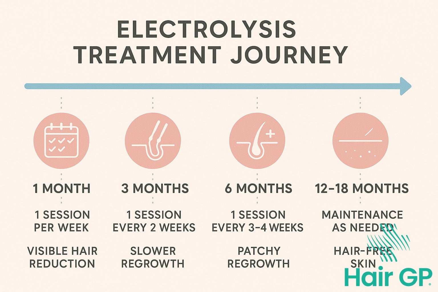 Infographic showing electrolysis treatment timeline for hirsutism over 12-18 months