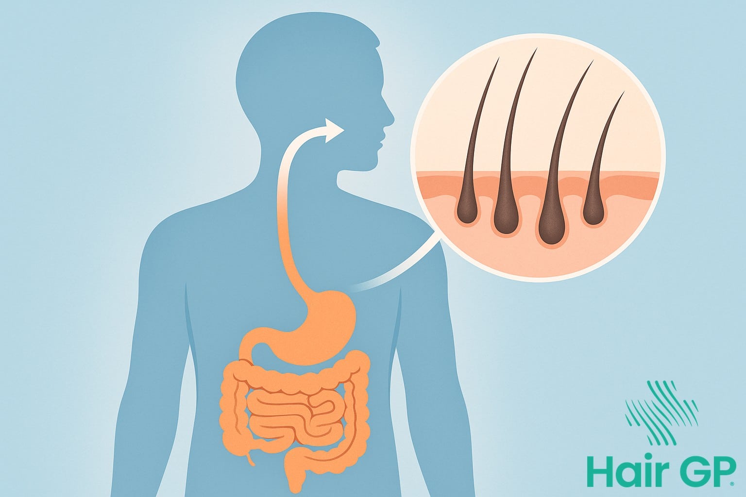 Illustration showing how food poisoning affects hair follicles through stress response