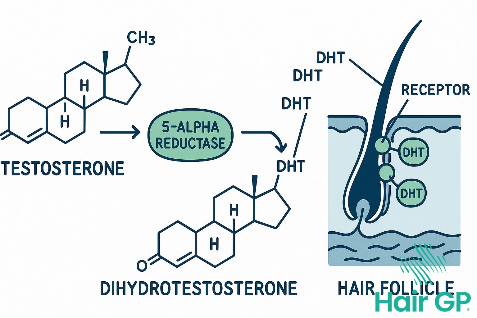 Diagram showing testosterone converting to DHT and affecting hair follicles